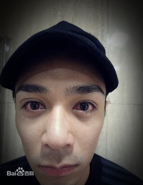 http://m.omega3-ala.com/pics/star/pic/62fe2ed9a02b1d441ba0830e462e937e.jpg